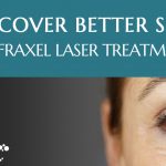 frequently-asked-questions-fraxel-laser-treatments