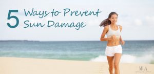 5 Ways to Prevent Age Spots and Sun Damage