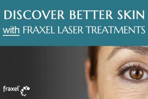 Frequently Asked Questions | Fraxel Laser Treatments